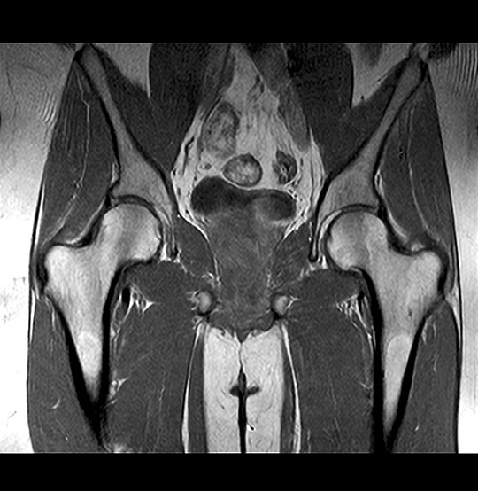 Hip MRI scan | Medserena Open MRI